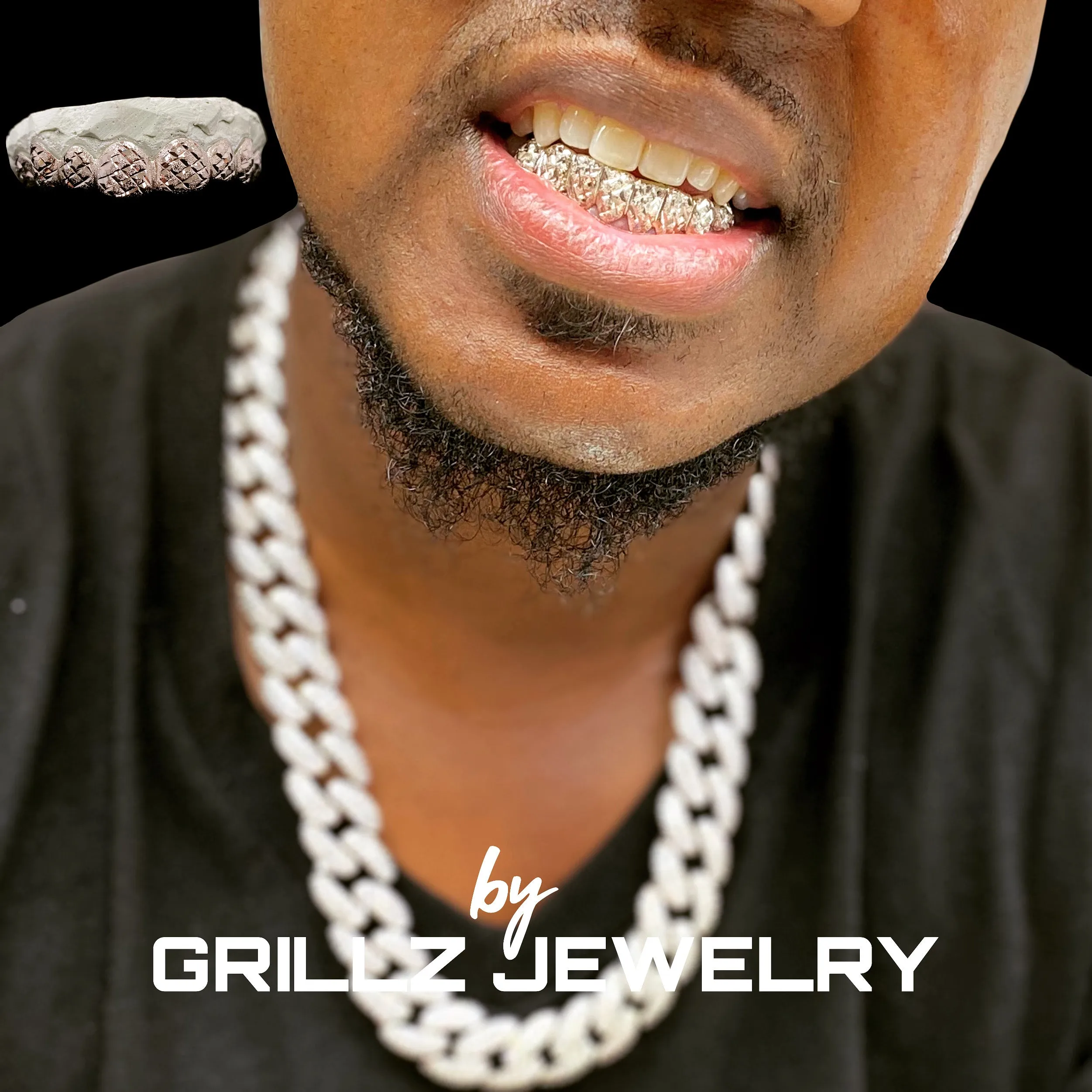 Mold kits for custom grillz
